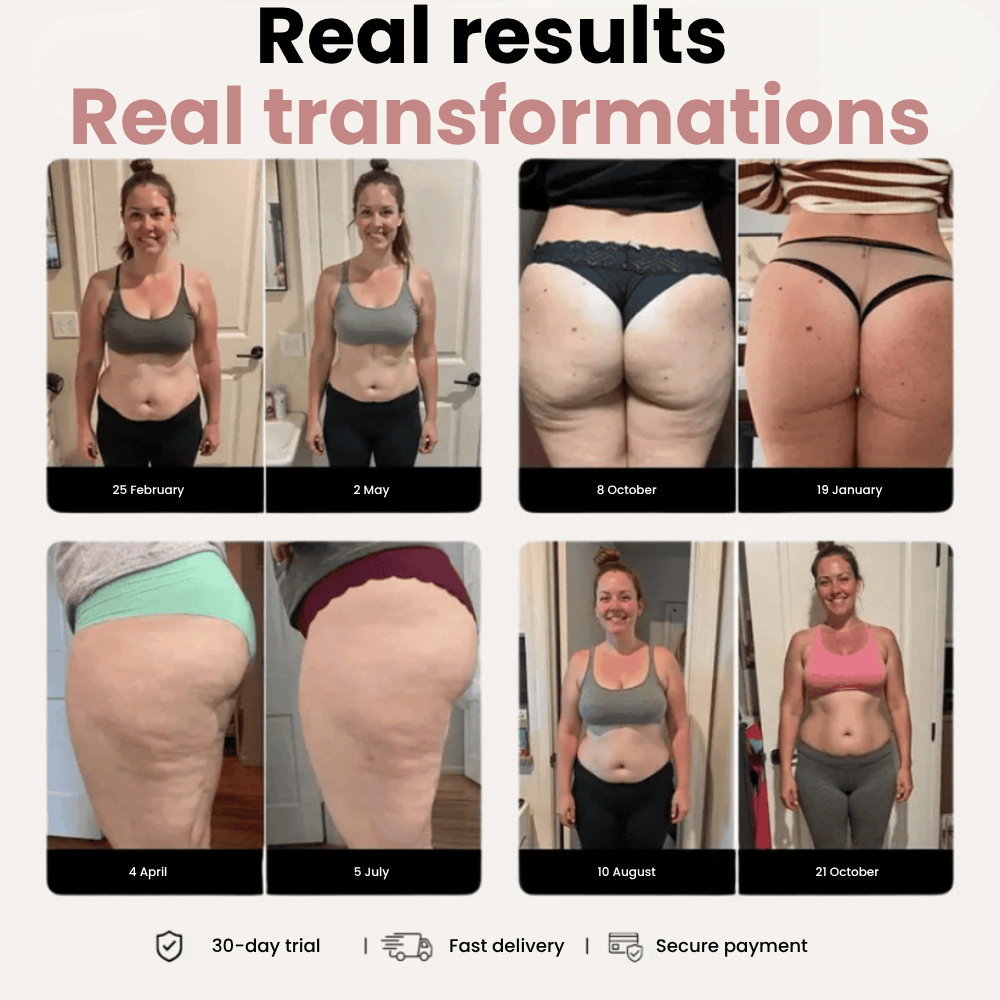 SERALLIA™ 3D Legging – Say goodbye to lipoedema pain and swelling naturally