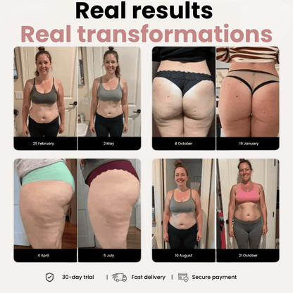 SERALLIA™ 3D Legging – Say goodbye to lipoedema pain and swelling naturally